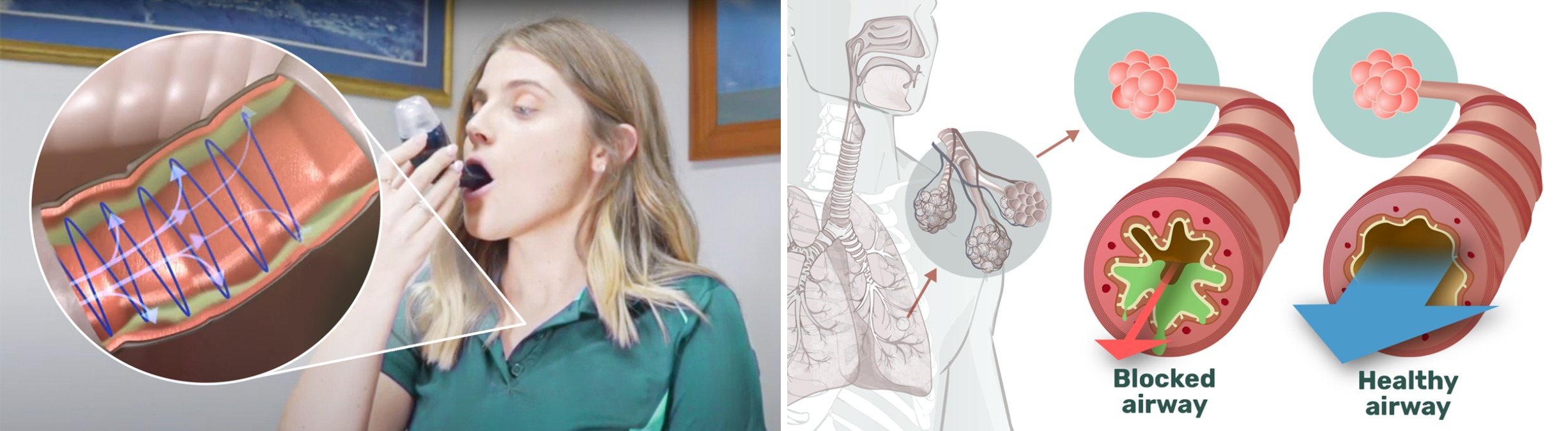Person using AirPhysio with airflow illustration and medical airway comparison