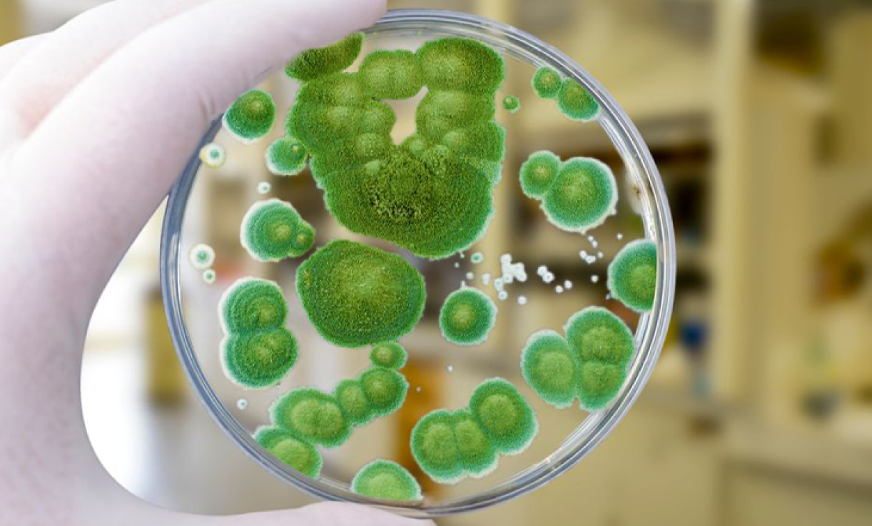 A gloved hand holding a petri dish with green bacterial colonies in a laboratory