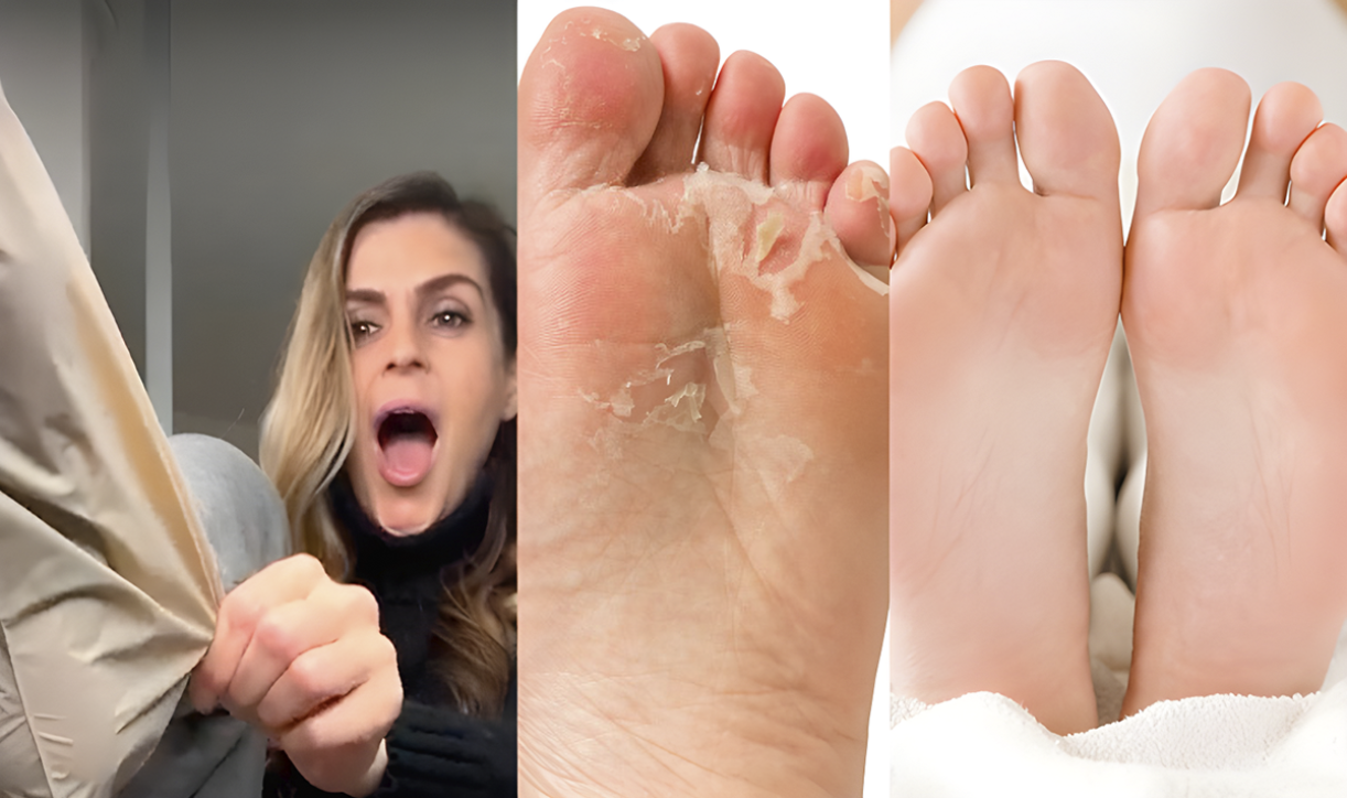 Three-panel: holding mask, peeling skin, smooth feet after FEETS Foot Peel Mask