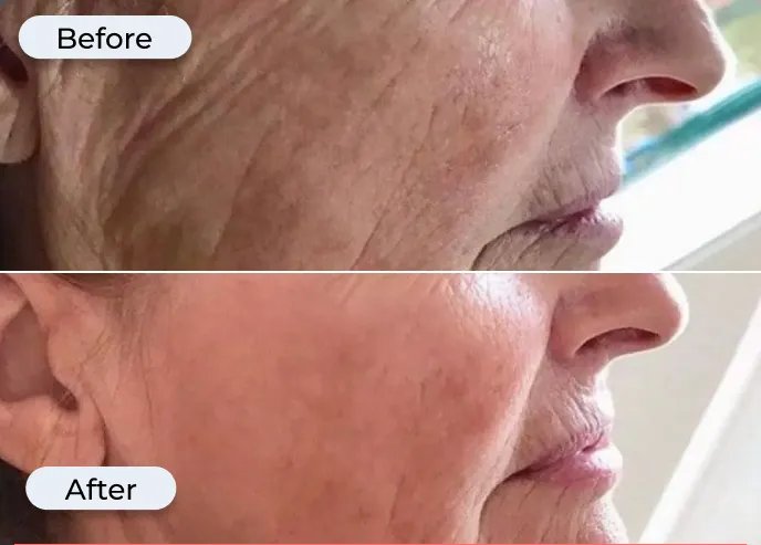 Before and after photo from Glamory's offer page showing under-eye fine lines