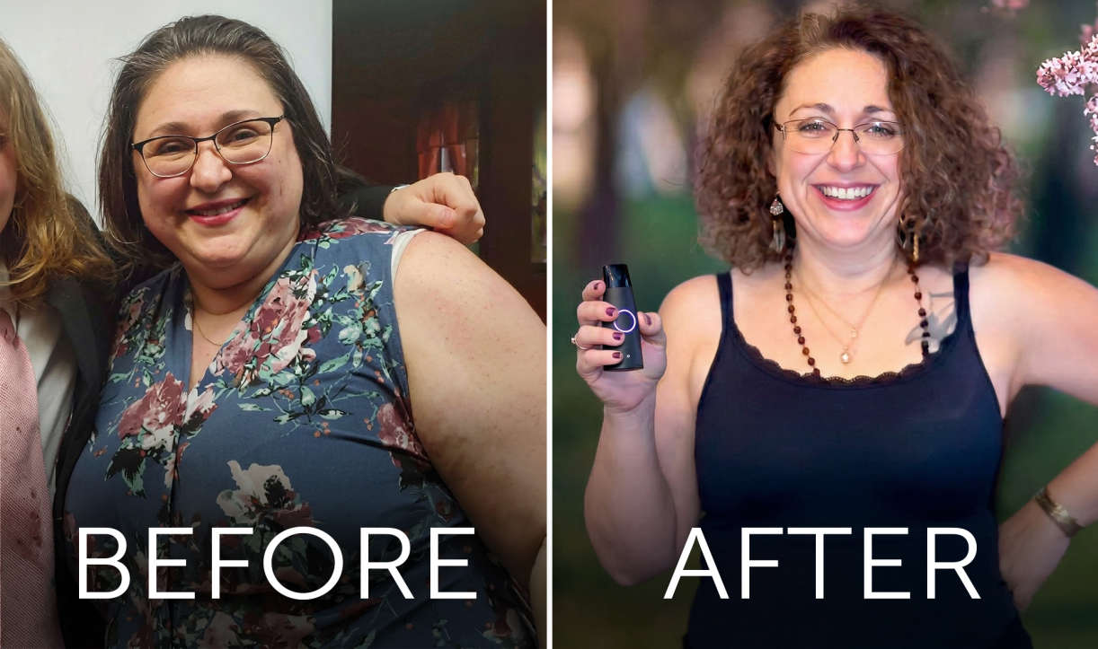 Before and after photos of a woman holding the device, showing weight loss results