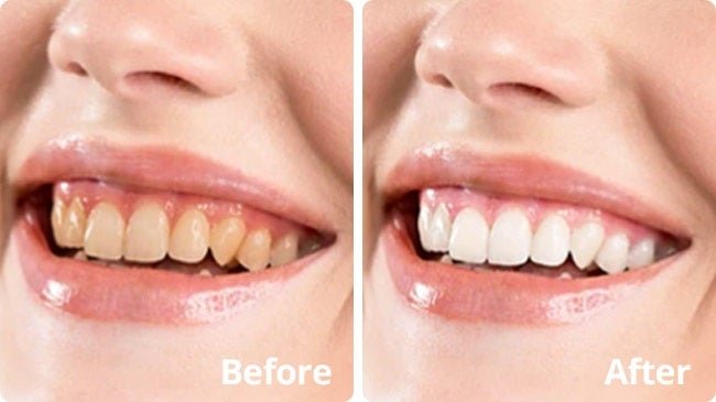 Our Real-World Experience With PurelyWHITE Deluxe