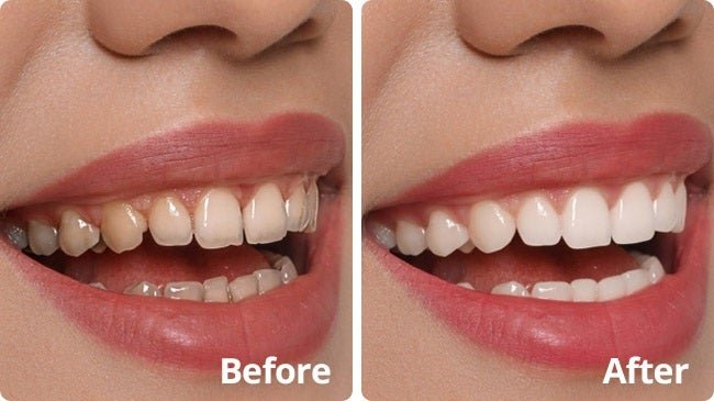 Person smiling while using an electric toothbrush and holding the product jar