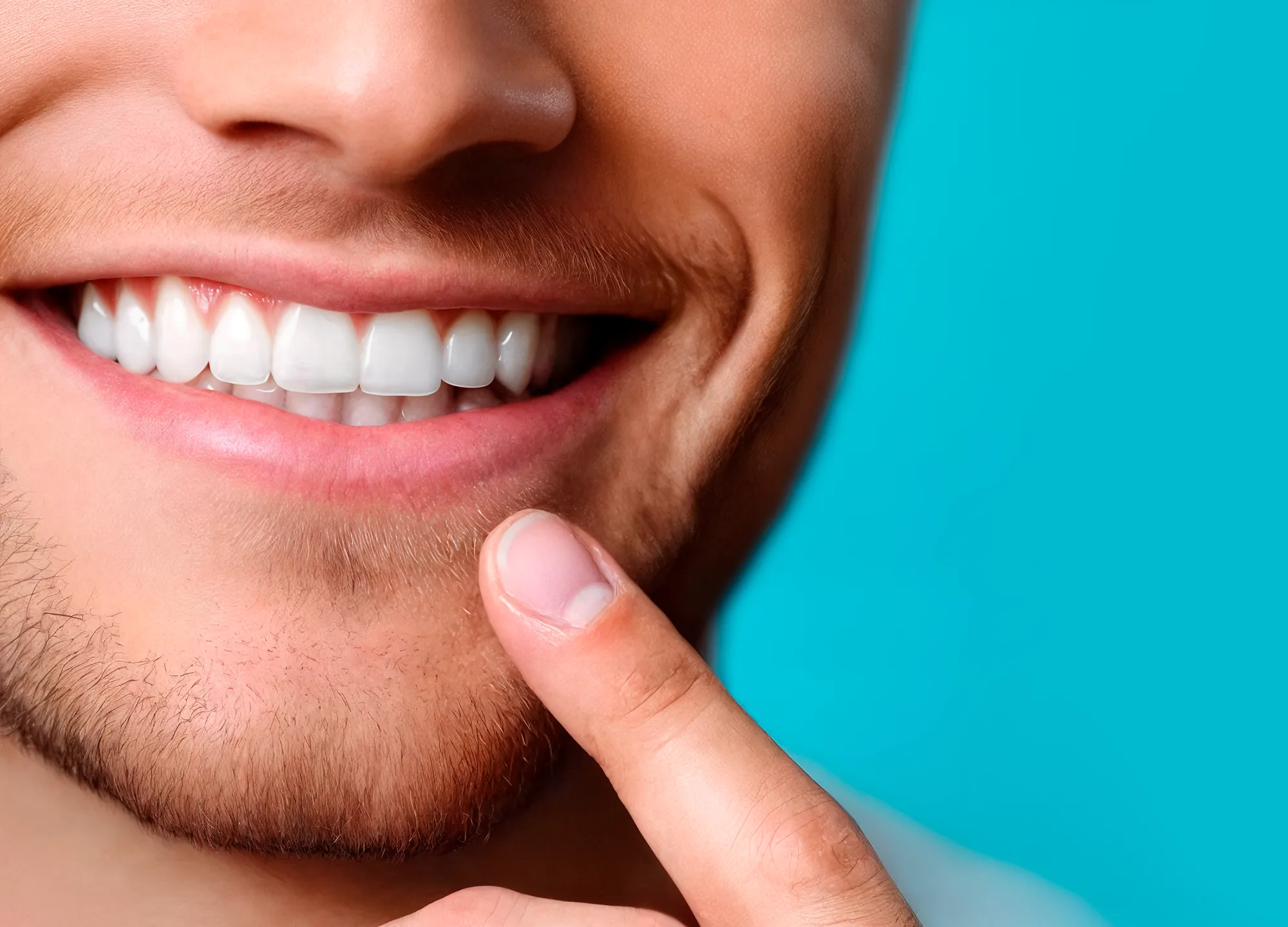 Close-up of a person smiling and pointing at their teeth with veneers