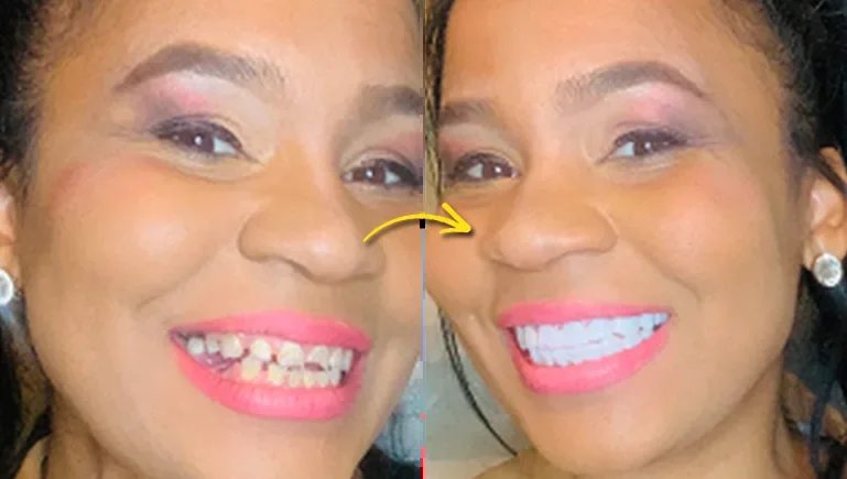 Our Real-World Experience With Shiny Smile