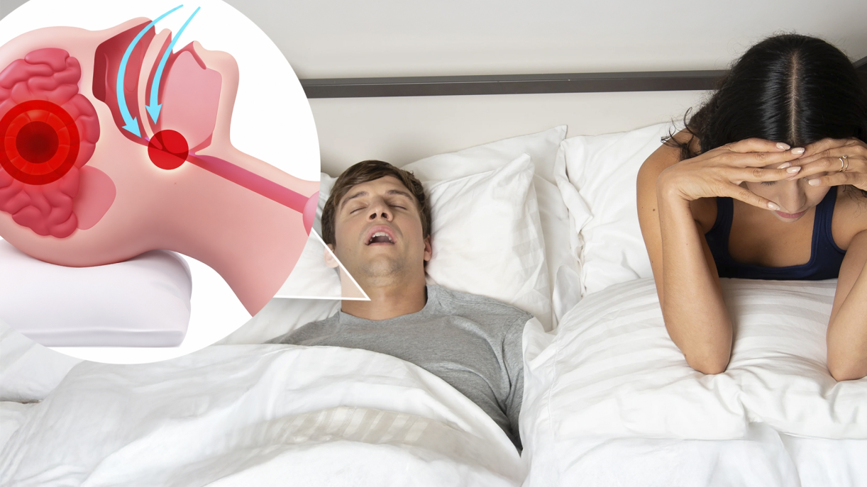 A diagram showing airflow blockage in a snoring person's throat with a concerned partner beside them