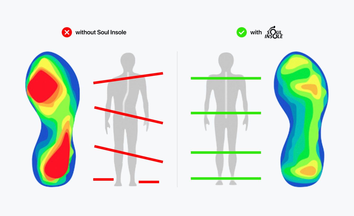 Diagram comparing foot pressure and body alignment with and without the insole